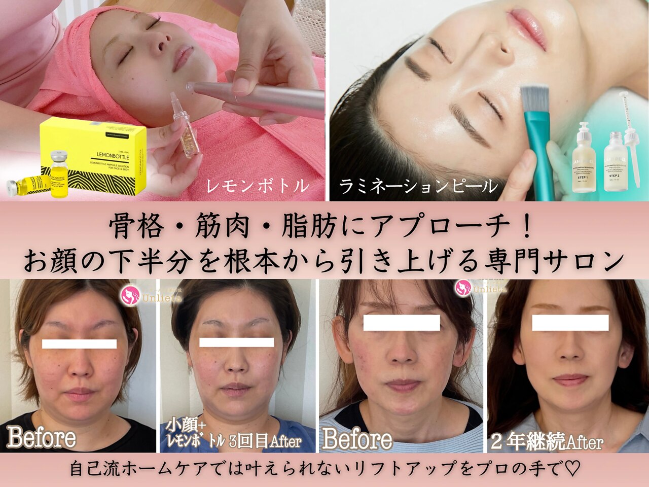 数回使用】ラミネーションピール