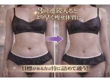 ヨサパーク スーパーマン 浦安東口店(YOSA PARK Superman)の雰囲気(直ぐに変われる!ダイエット/小顔/痩身/よもぎ蒸し)