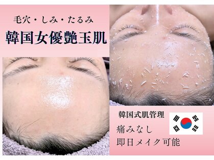 エルナ(Eluna)の写真