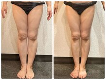 美容整体ウェリナ 中川八田院/小顔矯正/骨盤矯正/美脚サロン