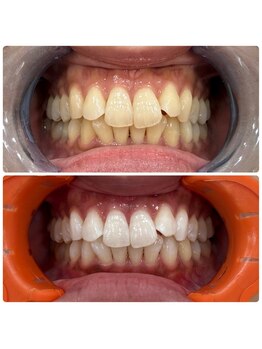 コナホワイトニング 神保町/御茶ノ水セルフホワイトニング