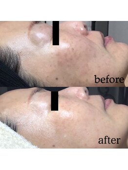 ケイリー(kaylee)/ハーブトリートメント