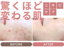 ハーティ