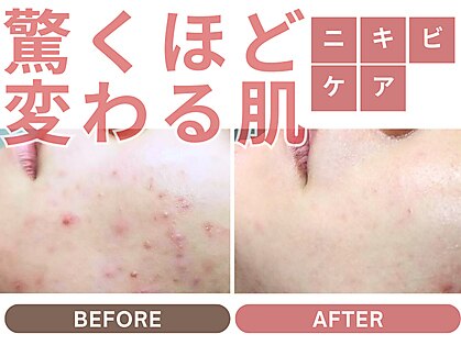 ハーティの写真
