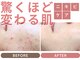 ハーティの写真