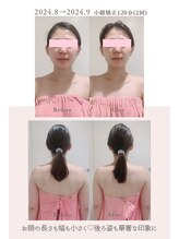 トゥインクル 麻布(twinkle)/南麻布/シンメトリー小顔矯正