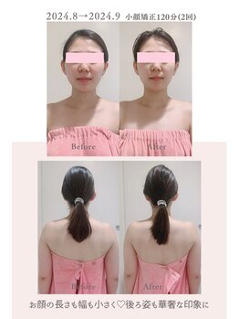 トゥインクル 麻布(twinkle)/南麻布/シンメトリー小顔矯正