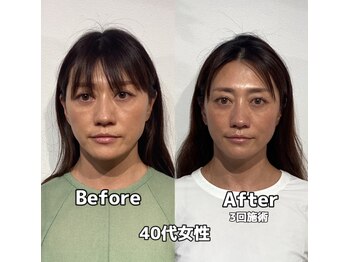 コルミチョン サロン(骨美整 salon)/40代女性　Before・After
