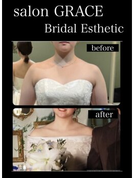 サロン グレイス(salon GRACE)/