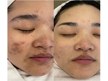 エルマナ(Hermana)/