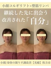 光癒(コウユ)/小顔コルギリフト×整筋リンパ