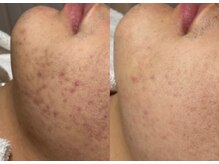 チュチュ(TUTU)/メンズもお任せ★