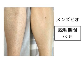 メンズビオ 神戸三宮店/