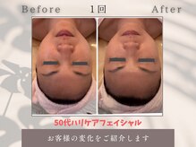 トータルビューティー雅/50代kらでも変われるんです！