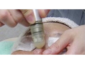 美光星の写真/シミ　乾燥ケア　肌質改善ピーリングコース　初回5500円