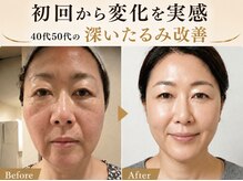サロンチオリ 烏丸(Salon Chiori)