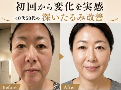 サロンチオリ 烏丸(Salon Chiori)の写真
