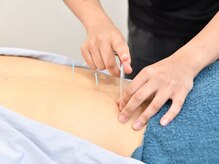 ウェルネス町田鍼灸院 整骨院(WELLNESS町田鍼灸院 整骨院)/鍼灸