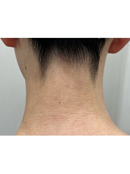 ボディシェービングメニューがあるサロン