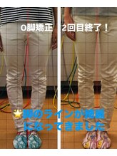 きょうわ整体院/O脚矯正・美脚矯正