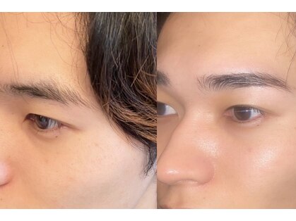 ワンビ(One be.)の写真