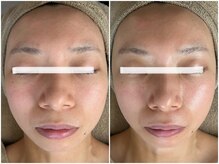 メイン(main)/★before after★