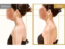 モニター様のビフォーアフター。喜びの声続出