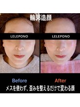 美容矯正サロン レレポノ(LELEPONO)/