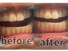 エスデザイン(es design)/1回の使用で3トーンUP