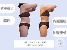 ベベティー(BEBETIE)/内臓脂肪・皮下脂肪どちらも対応