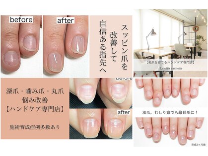 ルクレール カシェット(Le clair cachette)の写真