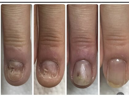 ケアロハネイル(Kealoha nail)の写真