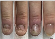 ケアロハネイル(Kealoha nail)