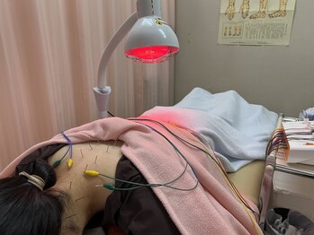 木下美容鍼灸整骨院の写真/首・肩のコリをほぐしてスッキリ解消!自律神経の乱れ/姿勢不良(猫背・巻き肩)/睡眠の質の低下/頭痛