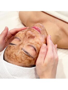 リトリート(Retreat)/ハーブピーリング肌質改善ケア☆