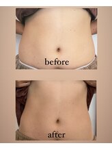 トナリ鍼灸院/スリミング