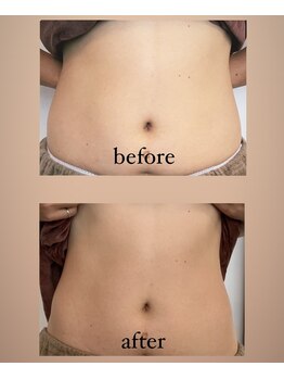 トナリ鍼灸院/スリミング