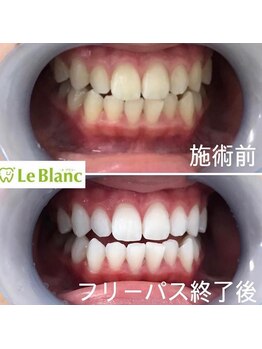 ルブラン 奈良店(Le Blanc)/毎日のケアも大切ですよ♪