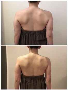 イズミ(IZUMI)/引き締め10回コース