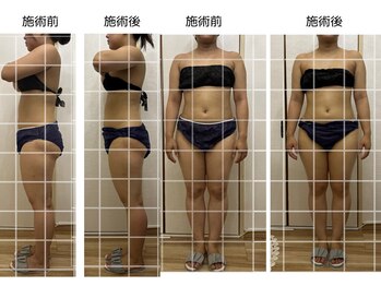 リア(Lia)/ビフォーアフター画像