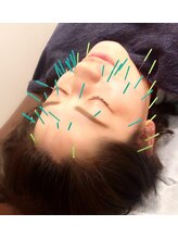 スカイ 鍼灸整骨院 整体院(SKY)/美容鍼