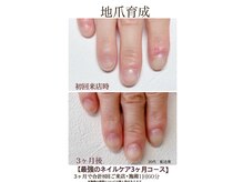 深爪、小さい爪にお悩みの方★育成ケアで美しいお爪へ導きます！