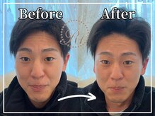 R-1ビューティーサロン 銀座/Before＆After