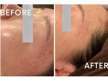 レゴリス 横浜店(REGOLITH)/