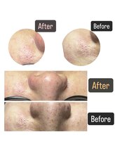 リル(Rire)/Before→After