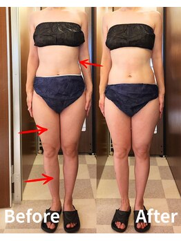 ヴィセル(VISEL)/トータルマイナス10cm痩身