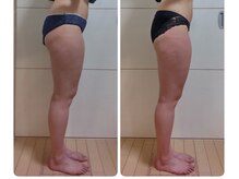 ヨサパーク モックス 堺東(YOSA PARK MOX)/40代前半　1週間に詰めて3回