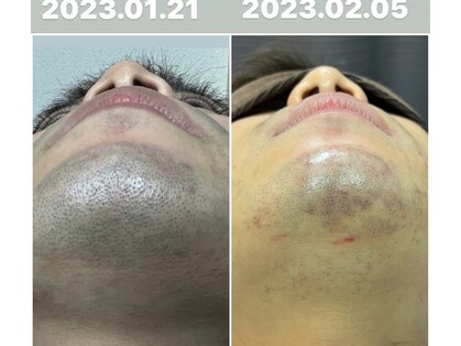 エステサロン オパール(OPALE)の写真