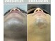 エステサロン オパール(OPALE)の写真