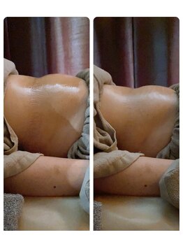 ヴァローレ(valore)/浮腫ケアとガス溜まりケア！